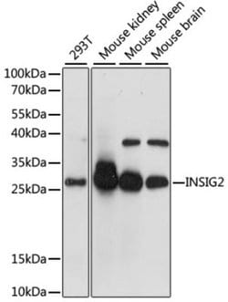 GCC185 Rabbit anti-Human, Mouse, Polyclonal, Novus Biologicals:Antibodies:Primary